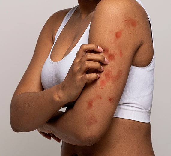 Topical treatments