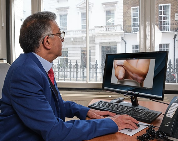 vitiligo consultation