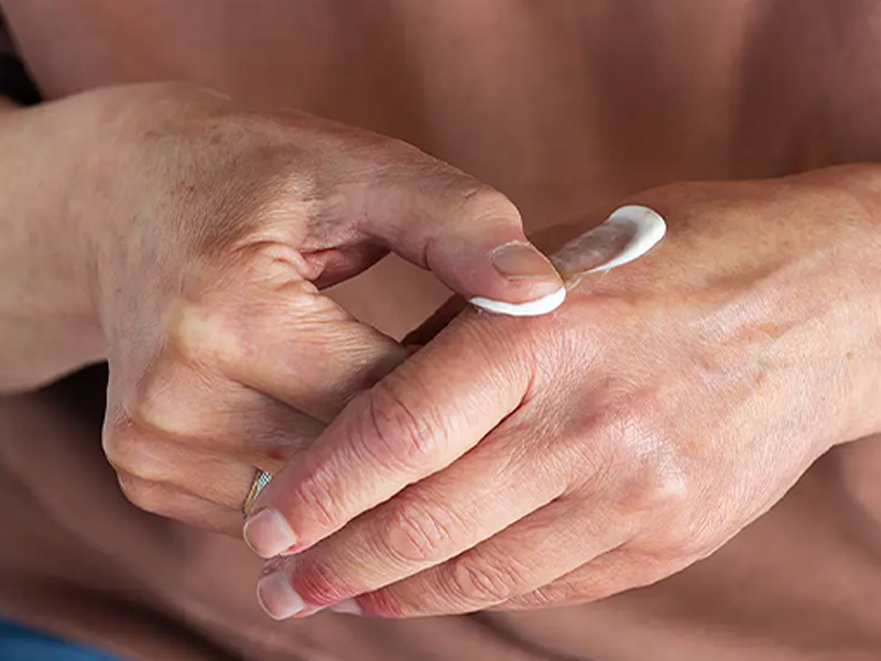 Topical treatment